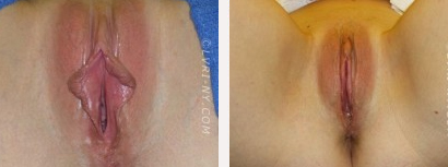 Before & After