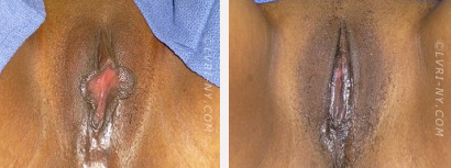 Before & After
