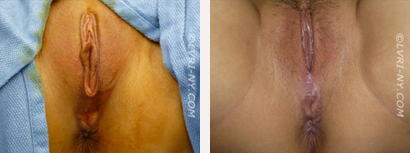 Before & After