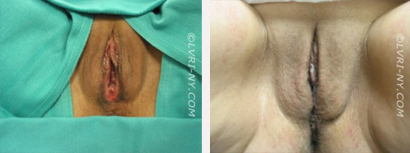 Before & After