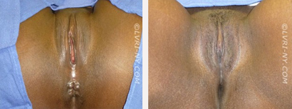 Before & After